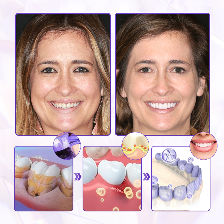 Biancat® BeeRenew Advanced Gum Healing Toothpaste🌟